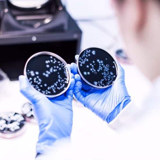 A laboratory technician examines two petri dishes containing microbial growth during a microbiological test for quality control and laboratory analysis.