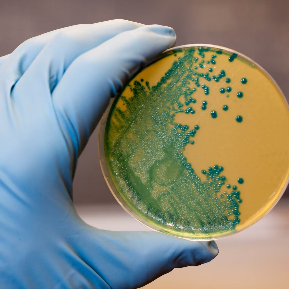 Petrischaal met blauwgroene bacteriekolonies op voedingsagar, vastgehouden met een laboratoriumhandschoen.