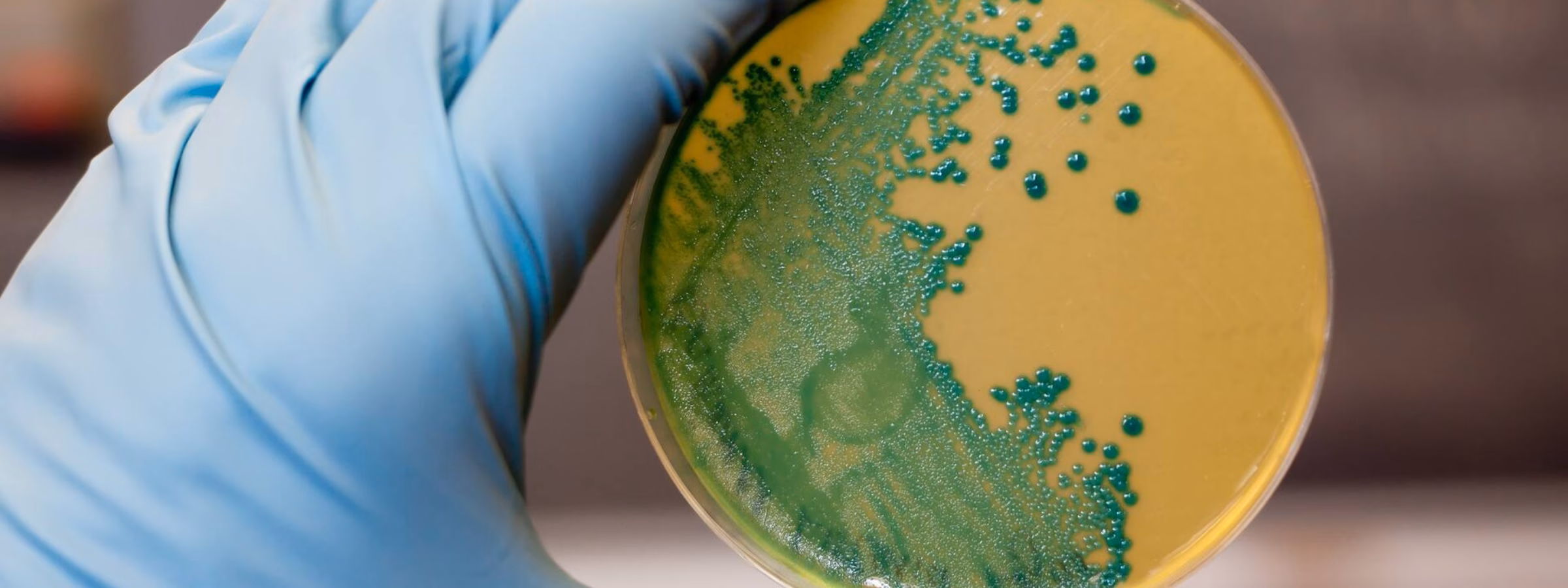 Petrischaal met blauwgroene bacteriekolonies op voedingsagar, vastgehouden met een laboratoriumhandschoen.