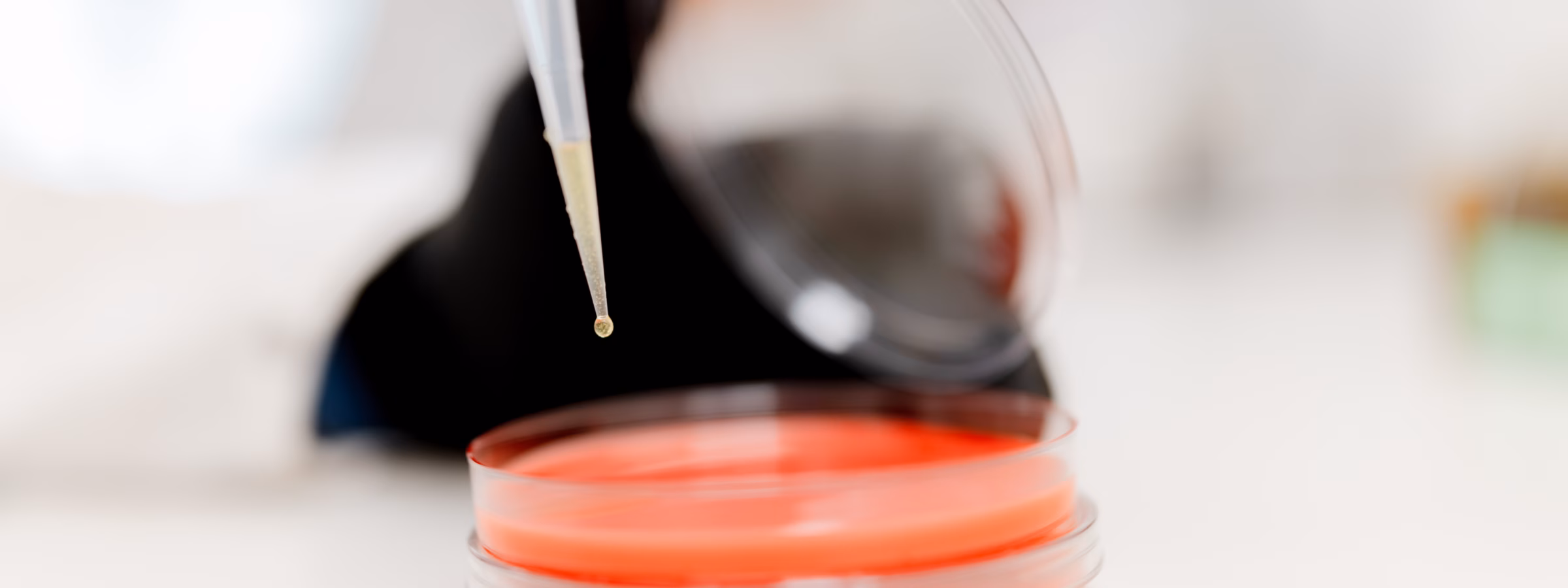 Een vloeistofmonster wordt met een pipet toegevoegd aan een petrischaal voor laboratoriumonderzoek.