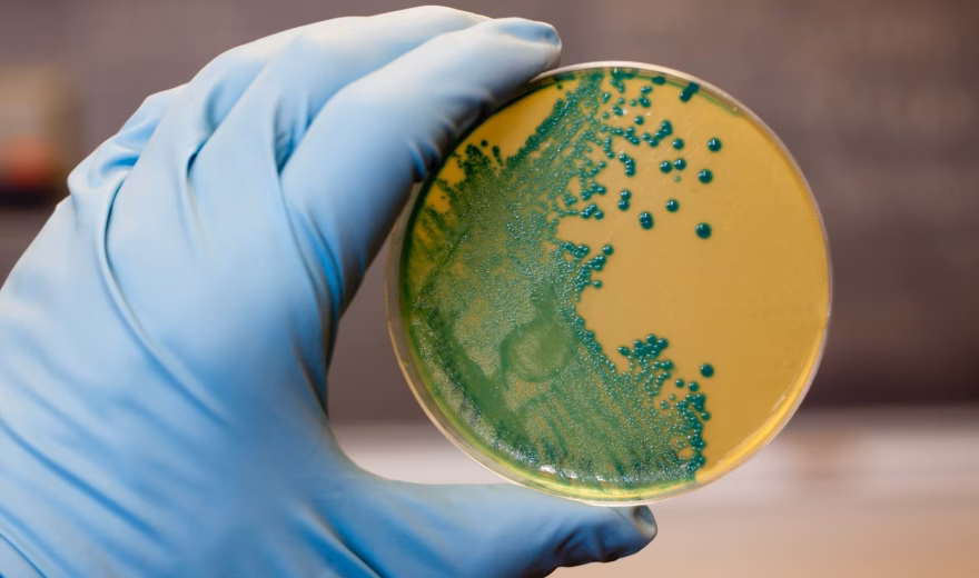 Petrischaal met blauwgroene bacteriekolonies op voedingsagar, vastgehouden met een laboratoriumhandschoen.