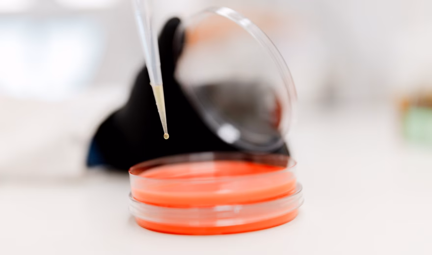 A liquid sample is added to a petri dish with a pipette for laboratory analysis.