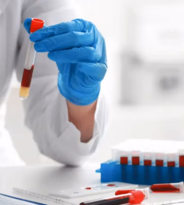 Een bloedmonster wordt verwerkt voor onderzoek en laboratoriumtesten.