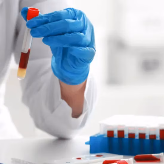 Een bloedmonster wordt verwerkt voor onderzoek en laboratoriumtesten.