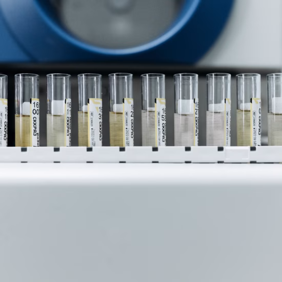 Des échantillons d'eau contenus dans des tubes à essai sont préparés en vue d'une analyse en laboratoire.
