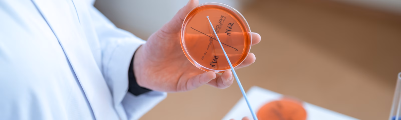 Laboratoriummedewerker houdt een petrischaaltje en een wattenstaaf vast tijdens microbiologisch onderzoek.