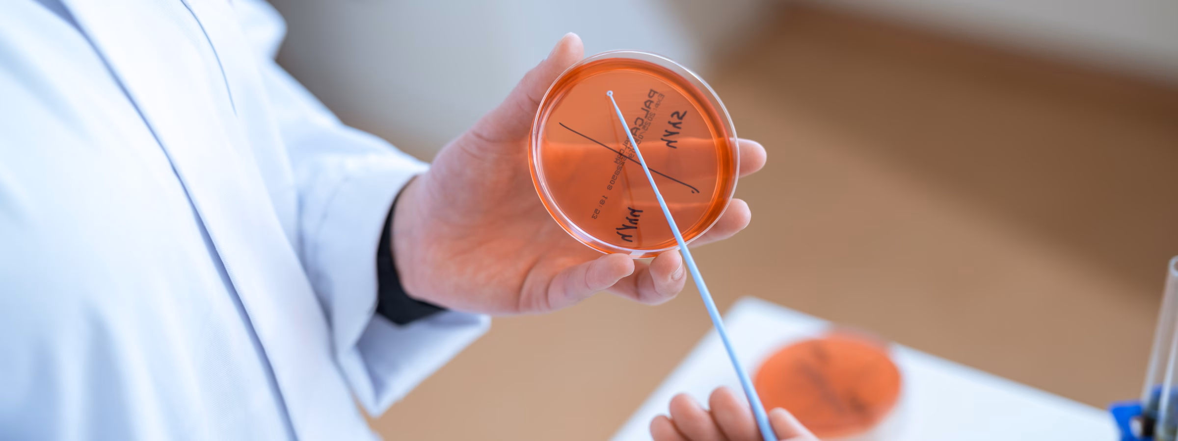 A laboratory technician holds a petri dish and a cotton swab during a microbiological examination.