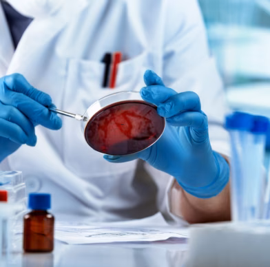 Un technicien de laboratoire portant des gants bleus tient une boîte de Pétri contenant une culture rouge lors d'une analyse microbiologique.