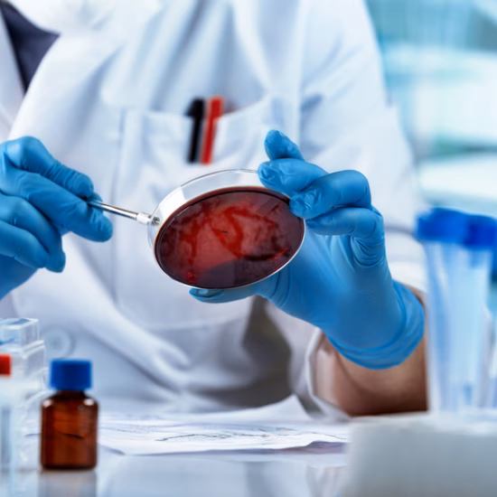 Laboratoriummedewerker met blauwe handschoenen houdt een petrischaal met rode kweek vast tijdens microbiologisch onderzoek.