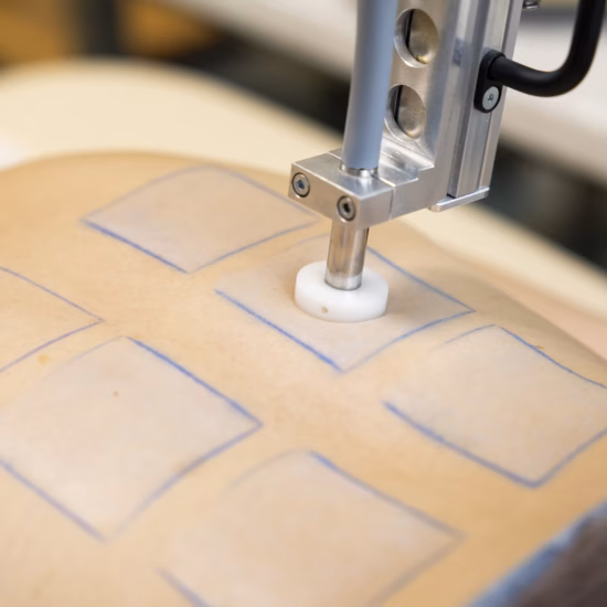 A medical device with a white tip touches the skin of a person on whom several small squares of blue ink have been applied as part of a skin test or similar procedure.