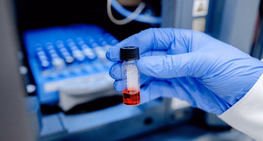 A laboratory glove holds a test tube containing a red liquid for use with laboratory equipment for sample testing.