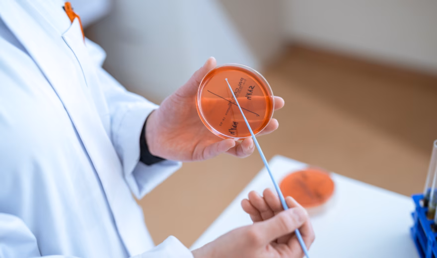 Laboratoriummedewerker houdt een petrischaaltje en een wattenstaaf vast tijdens microbiologisch onderzoek.